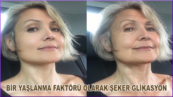 KADINCAeu-20191109-2200-SAGLIK-Seker-Ozlem-Coskun-05-678x381